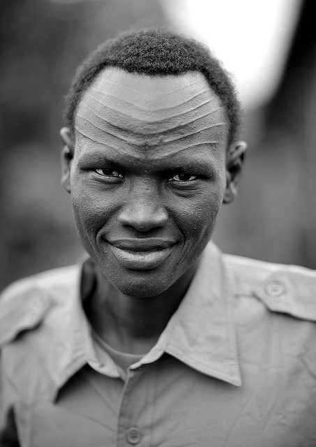 Close-up of a man with textured skin